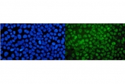 Immunofluorescent staining of FFPE human A431 cells with MED4 antibody (green) and DAPI nuclear stain (blue). HIER: steam section in pH6 citrate buffer for 20 min.
