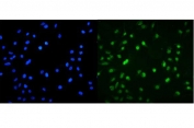 Immunofluorescent staining of FFPE human A549 cells with MNT antibody (green) and DAPI nuclear stain (blue). HIER: steam section in pH6 citrate buffer for 20 min.