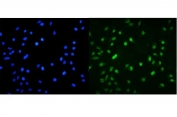 Immunofluorescent staining of FFPE human A549 cells with MNT antibody (green) and DAPI nuclear stain (blue). HIER: steam section in pH6 citrate buffer for 20 min.
