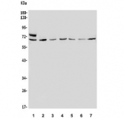 Western blot testing of human 1) HeLa, 2) Raji, 3) A549, 4) HEK293, 5) K562, 6) PC-3 and 7) Caco-2 lysate with MNT antibody. Predicted molecular weight ~62 kDa.