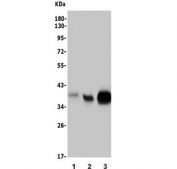 Western blot testing of human 1) U-2 OS, 2) T-47D and 3) COLO-320 lysate with Musashi 1 antibody. Predicted molecular weight ~39 kDa.