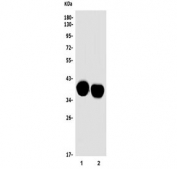Western blot testing of 1) rat brain and 2) mouse brain tissue lysate with Mtnd2 antibody. Predicted molecular weight ~39 kDa.