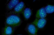 Immunofluorescent staining of FFPE human HeLa cells with Nectin 2 antibody (green) and DAPI nuclear stain (blue). HIER: steam section in pH6 citrate buffer for 20 min.