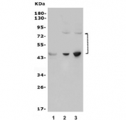 Western blot testing of 1) rat brain, 2) human SW620 and 3) human Caco-2 lysate with NGF Receptor antibody. Predicted molecular weight ~45/75 kDa (unmodified/glycosylated).