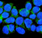 Immunofluorescent staining of FFPE human A431 cells with NGF Receptor antibody (green) and DAPI nuclear stain (blue). HIER: steam section in pH6 citrate buffer for 20 min.