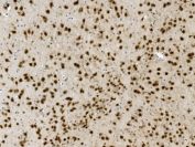 IHC staining of FFPE mouse brain with NOVA2 antibody. HIER: boil tissue sections in pH8 EDTA for 20 min and allow to cool before testing.