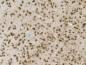 IHC staining of FFPE mouse brain with NOVA2 antibody. HIER: boil tissue sections in pH8 EDTA for 20 min and allow to cool before testing.