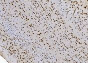 IHC staining of FFPE mouse brain with NOVA2 antibody. HIER: boil tissue sections in pH8 EDTA for 20 min and allow to cool before testing.