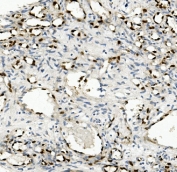 IHC staining of FFPE human appendicitis tissue with NOVA2 antibody. HIER: boil tissue sections in pH8 EDTA for 20 min and allow to cool before testing.