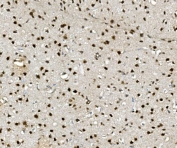 IHC staining of FFPE rat brain with NOVA2 antibody. HIER: boil tissue sections in pH8 EDTA for 20 min and allow to cool before testing.