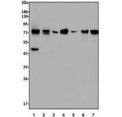 Western blot testing of human 1) U-2 OS, 2) HL60, 3) ThP-1, 4) rat brain, 5) rat spleen, 6) rat lung and 7) mouse brain lysate with NOVA2 antibody. Expected molecular weight: 70-80 kDa with a 50-55 kDa band also sometimes seen (Ref 1).