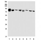 Western blot testing of 1) rat ovary, 2) rat kidney, 3) mouse ovary, 4) mouse kidney, 5) human HEK293, 6) monkey kidney, 7) rat NRK and 8) monkey COS-7 cell lysate with PHEX antibody. Predicted molecular weight ~86 kDa.