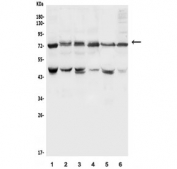 Western blot testing of human 1) HepG2, 2) Jurkat, 3) HEK293, 4) Raji, 5) K562 and 6) HeLa lysate with PIAS1 antibody. Expected molecular weight: 72-100 kDa.