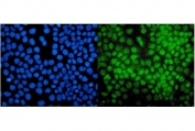 Immunofluorescent staining of FFPE human A431 cells with PIAS1 antibody (green) and DAPI nuclear stain (blue). HIER: steam section in pH6 citrate buffer for 20 min.