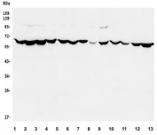 Western blot testing of human 1) K562, 2) HeLa, 3) HepG2, 4) HEK293, 5) HL-60, 6) Raji, 7) A431, 8) rat brain, 9) rat C6, 10) mouse brain, 11) mouse testis, 12) mouse Neuro-2a and 13) mouse RAW264.7 lysate with PIAS2 antibody. Predicted molecular weight: ~63 kDa.