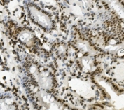 IHC staining of FFPE mouse intestine with PRDM5 antibody. HIER: boil tissue sections in pH8 EDTA for 20 min and allow to cool before testing.