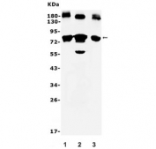 Western blot testing of 1) human HL60, 2) rat ovary and 3) mouse ovary. Predicted molecular weight ~73 kDa.