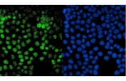 Immunofluorescent staining of FFPE human A431 cells with PTF1A antibody (green) and DAPI nuclear stain (blue). HIER: steam section in pH6 citrate buffer for 20 min.