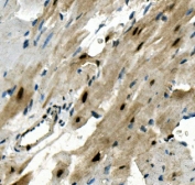 IHC staining of FFPE mouse heart with RBPMS antibody. HIER: boil tissue sections in pH8 EDTA for 20 min and allow to cool before testing.