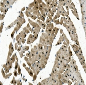 IHC staining of FFPE rat heart with RBPMS antibody. HIER: boil tissue sections in pH8 EDTA for 20 min and allow to cool before testing.