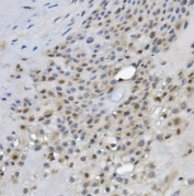 IHC staining of FFPE human placenta with REC8 antibody. HIER: boil tissue sections in pH8 EDTA for 20 min and allow to cool before testing.