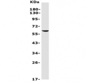 Western blot testing of human Jurkat lysate with REC8 antibody. Predicted molecular weight ~63 kDa.