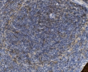 IHC staining of FFPE rat spleen with Psgl-1 antibody. HIER: boil tissue sections in pH8 EDTA for 20 min and allow to cool before testing.
