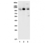 Western blot testing of 1) rat spleen, 2) rat thymus and 3) mouse thymus lysate with Psgl-1 antibody. Expected molecular weight: 42-110 kDa depending on glycosylation level. An ~250 kDa homodimer may also be detected.