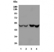 Western blot testing of rat liver (lanes 1-2) and monkey liver (lanes 3-4) lysate with Kallistatin antibody. Predicted molecular weight ~49 kDa.