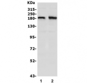 Western blot testing of human 1) SW620 and 2) U-87 MG lysate with hSET1 antibody. Predicted molecular weight ~186 kDa.