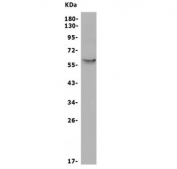 Western blot testing of human HepG2 cell lysate with SLC2A10 antibody. Expected molecular weight: 57-63 kDa.