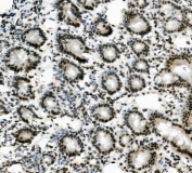 IHC staining of FFPE mouse intestine with Vinexin antibody. HIER: boil tissue sections in pH8 EDTA for 20 min and allow to cool before testing.