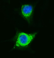 Immunofluorescent staining of FFPE human A549 cells with Vinexin antibody (green) and DAPI nuclear stain (blue). HIER: steam section in pH6 citrate buffer for 20 min.