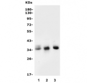 Western blot testing of 1) human PC-3, 2) rat brain and 3) mouse brain lysate with SPRY2 antibody. Expected molecular weight: 35-39 kDa, may be observed as a doublet.
