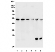 Western blot testing of 1) rat lung, 2) mouse lung, 3) rat thymus, 4) mouse thymus, 5) human HeLa and 6) human ThP-1 lysate with SS-A antibody. Predicted molecular weight ~54 kDa.