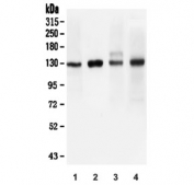 Western blot testing of 1) human A549, 2) human ThP-1, 3) rat brain and 4) mouse brain lysate with ULK1 antibody. Predicted molecular weight: 112-150 kDa.
