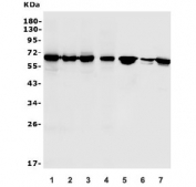 Western blot testing of human 1) HeLa, 2) HepG2, 3) PANC-1, 4) HEK293, 5) rat kidney, 6) mouse kidney and 7) mouse RAW264.7 lysate with USP21 antibody. Predicted molecular weight ~63 kDa.