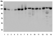 Western blot testing of 1) human HEK293, 2) human placenta, 3) monkey liver, 4) monkey kidney, 5) human PC-3, 6) human HeLa, 7) human A549, 8) rat kidney, 9) rat liver, 10) rat lung, 11) rat PC-12, 12) mouse lung, 13) mouse RAW264.7 and 14) mouse NIH 3T3 lysate with USP25 antibody. Predicted molecular weight ~122 kDa. 