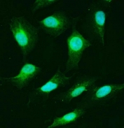 Immunofluorescent staining of FFPE human A549 cells with USP25 antibody (green) and DAPI nuclear stain (blue). HIER: steam section in pH6 citrate buffer for 20 min.