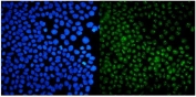 Immunofluorescent staining of FFPE human A431 cells with USP44 antibody (green) and DAPI nuclear stain (blue). HIER: steam section in pH6 citrate buffer for 20 min.