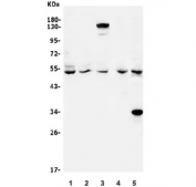 Western blot testing of human 1) K562, 2) Raji, 3) HEK293, 4) rat brain and 5) mouse testis lysate with VPS4A antibody. Predicted molecular weight ~49 kDa.