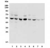 Western blot testing of human 1) HeLa, 2) HEK293, 3) Jurkat, 4) SK-O-V3, 5) rat kidney, 6) rat PC-3, 7) mouse brain and 8) mouse NIH 3T3 lysate with VPS4B antibody. Predicted molecular weight ~49 kDa.