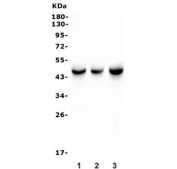 Western blot testing of 1) rat liver, 2) rat RH35 and 3) mouse liver lysate with Isocitrate Dehydrogenase antibody. Predicted molecular weight ~46 kDa.