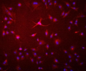 Immunofluorescent staining of FFPE human A549 cells with Glucosidase Alpha Acid antibody antibody (red) and DAPI nuclear stain (blue). HIER: steam section in pH6 citrate buffer for 20 min.