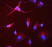 Immunofluorescent staining of FFPE human A549 cells with Glucosidase Alpha Acid antibody antibody (red) and DAPI nuclear stain (blue). HIER: steam section in pH6 citrate buffer for 20 min.