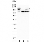 Western blot testing of human 1) A549, 2) HEK293 and 3) PC-3 lysate with Glucosidase Alpha Acid antibody. Expected molecular weight ~110 kDa (precursor), ~95 kDa (intermediate), ~76 and 70 kDa (lysosomal forms).
