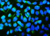Immunofluorescent staining of FFPE human U-2 OS cells with Mitofusin 1 antibody (green) and DAPI nuclear stain (blue). HIER: steam section in pH6 citrate buffer for 20 min.