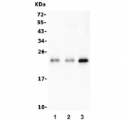 Western blot testing of 1) rat brain, 2) rat liver and 3) mouse ANA-1 lysate with HMG4 antibody. Predicted molecular weight ~23 kDa.
