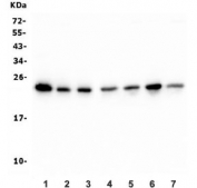 Western blot testing of human 1) placenta, 2) HeLa, 3) T-47D, 4) HepG2, 5) Caco-2, 6) SW620 and 7) Raji lysate with HMG4 antibody. Predicted molecular weight ~23 kDa.
