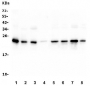 Western blot testing of human 1) placenta, 2) HeLa, 3) T-47D, 4) A431, 5) HepG2, 6) Caco-2, 7) SW620 and 8) Raji lysate with HMGB3 antibody. Predicted molecular weight ~23 kDa